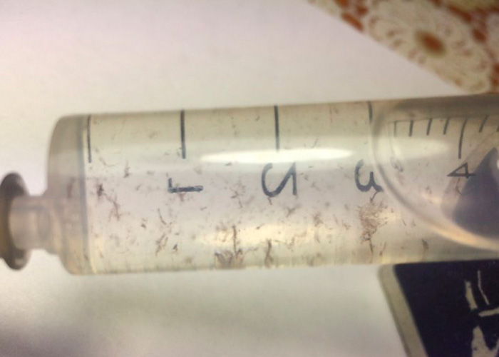 Как вырастить псилоцибиновые грибы из шприца со спорами